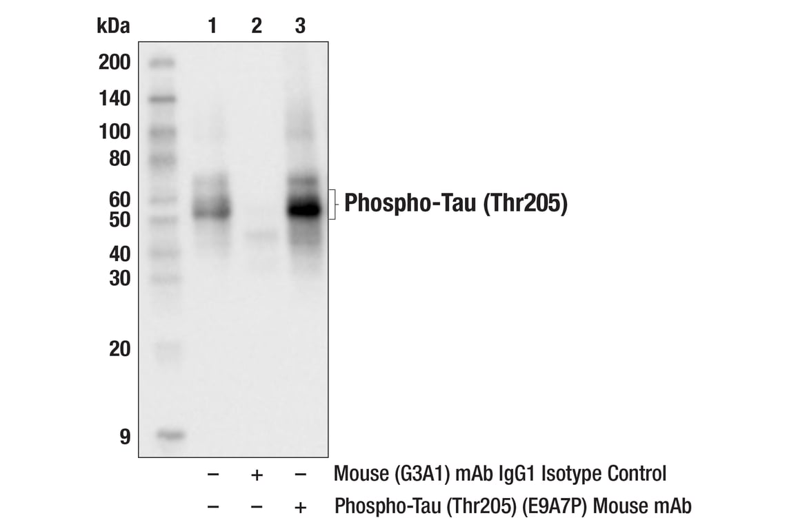 Immunoprecipitation Image 1: Phospho-Tau (Thr205) (E9A7P) Mouse Monoclonal Antibody