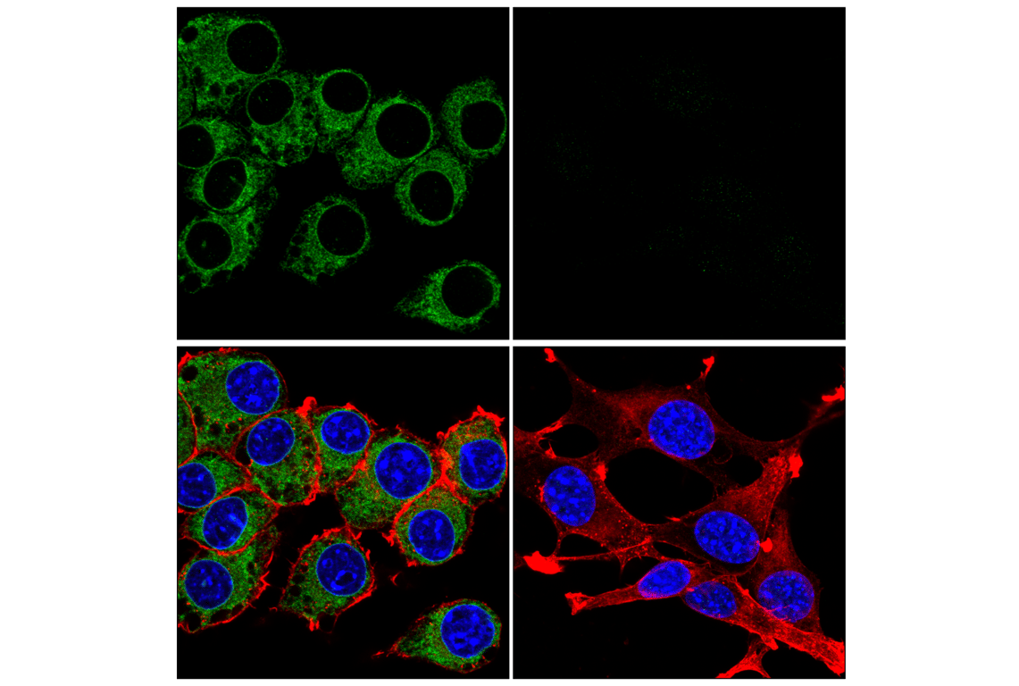Immunofluorescence Image 1: STING (E9X7F) Rabbit Monoclonal Antibody
