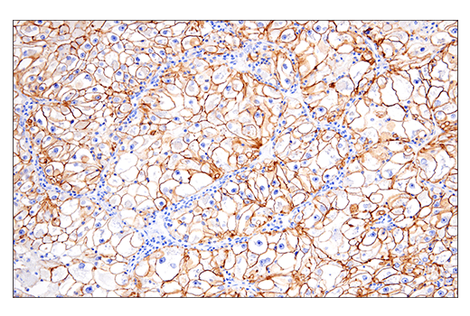 Immunohistochemistry Image 2: NCAM1 (CD56) (E7X9M) Rabbit Monoclonal Antibody