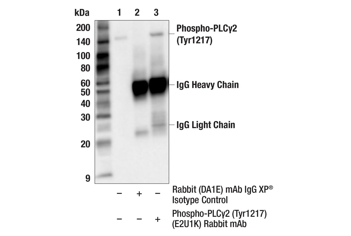 Immunoprecipitation Image 1: Phospho-PLC gamma2 (Tyr1217) (E2U1K) Rabbit Monoclonal Antibody