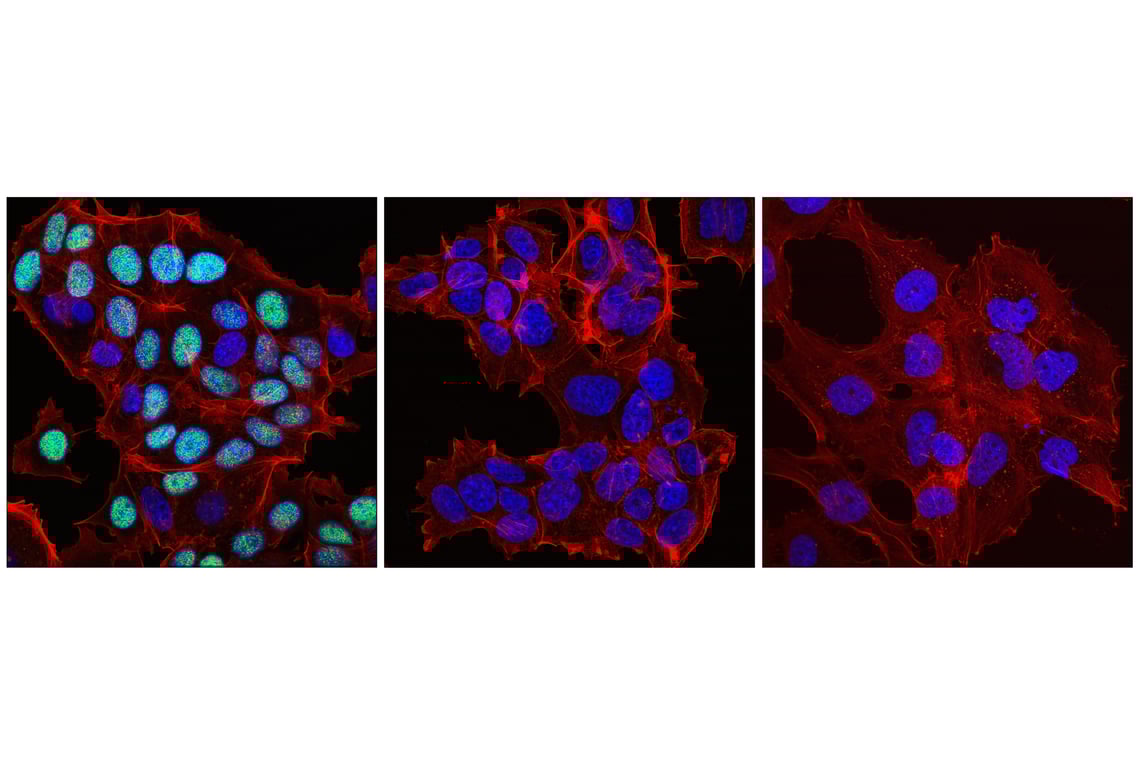 Immunofluorescence Image 1: Phospho-Rb (Ser807) (E8X7B) Rabbit Monoclonal Antibody