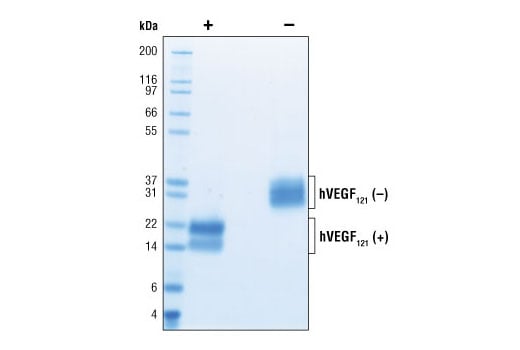 undefined Image 2: Human Vascular Endothelial Growth Factor-121 (hVEGF<sub>121</sub> )