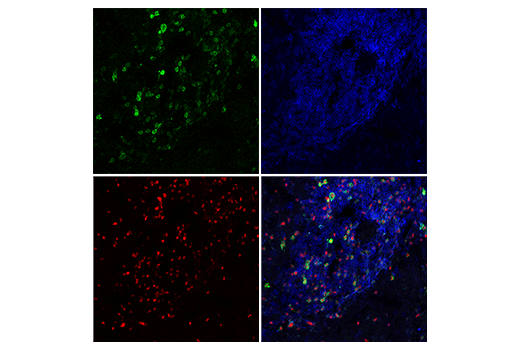 Immunofluorescence Image 1: IL-2R alpha/CD25 (E9W2J) Rabbit Monoclonal Antibody