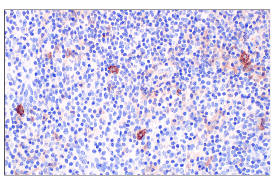 Immunohistochemistry Image 2: GLIPR2 (F7H7V) Rabbit Monoclonal Antibody