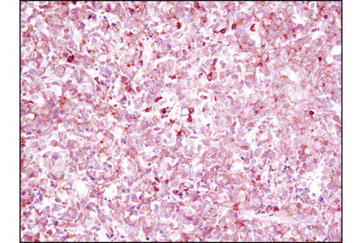 Immunohistochemistry Image 3: NFAT1 (D43B1) Rabbit Monoclonal Antibody (BSA and Azide Free)