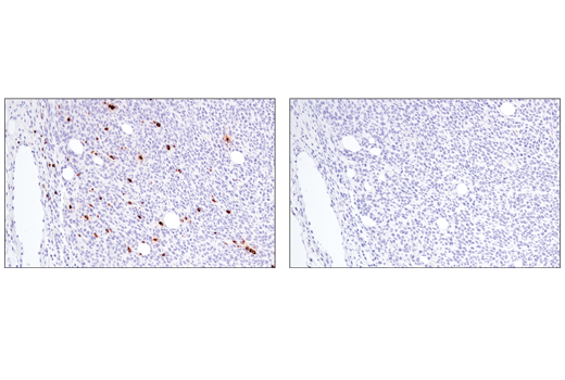 Immunohistochemistry Image 1: Perforin (E3W4I) Rabbit Monoclonal Antibody