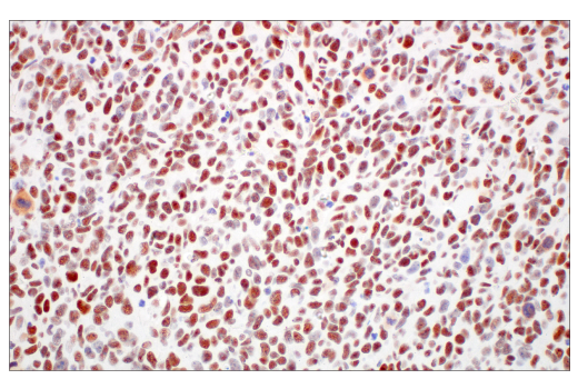 Immunohistochemistry Image 8: XRCC1 (E4A3V) Rabbit Monoclonal Antibody