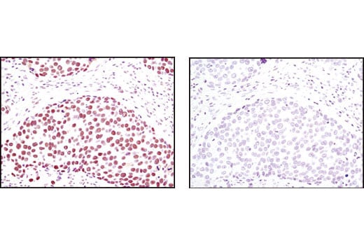 Immunohistochemistry Image 1: KAP-1 (C42G12) Rabbit Monoclonal Antibody (BSA and Azide Free)