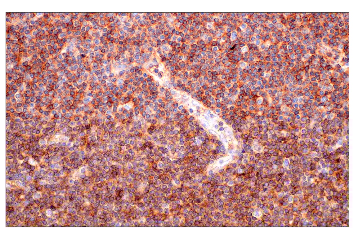 Immunohistochemistry Image 1: CD62L/L-Selectin (E7X9I) Rabbit Monoclonal Antibody (BSA and Azide Free)