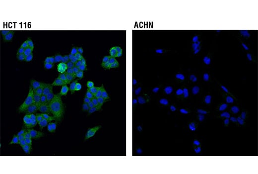 undefined Image 19: Hippo Signaling Antibody Sampler Kit