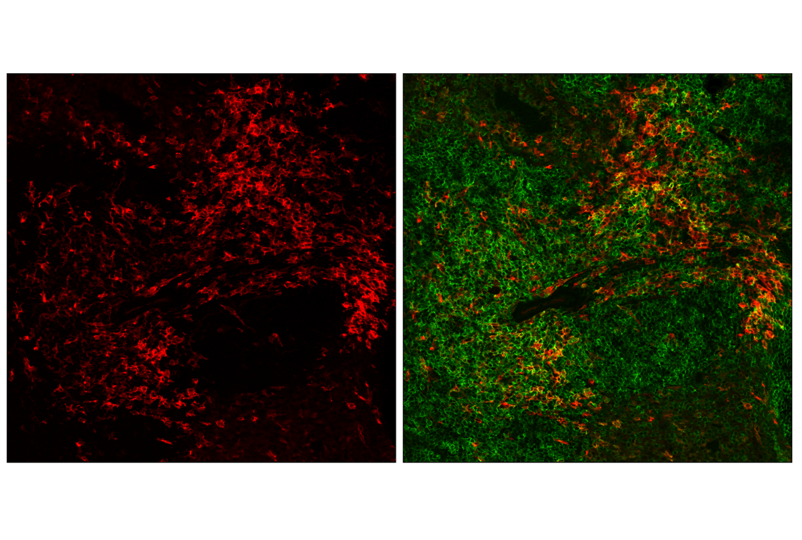 Immunofluorescence Image 2: CD11c (D1V9Y) Rabbit Monoclonal Antibody (Alexa Fluor<sup>®</sup> 647 Conjugate)