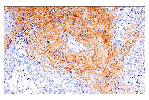 undefined Image 28: ECM Profiling Antibody Sampler Kit