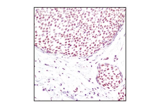 Immunohistochemistry Image 1: Di-Methyl-Histone H3 (Lys4) (C64G9) Rabbit Monoclonal Antibody (BSA and Azide Free)