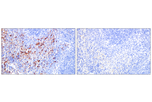 Immunohistochemistry Image 8: CD206/MRC1 (E6T5J) Rabbit Monoclonal Antibody (BSA and Azide Free)