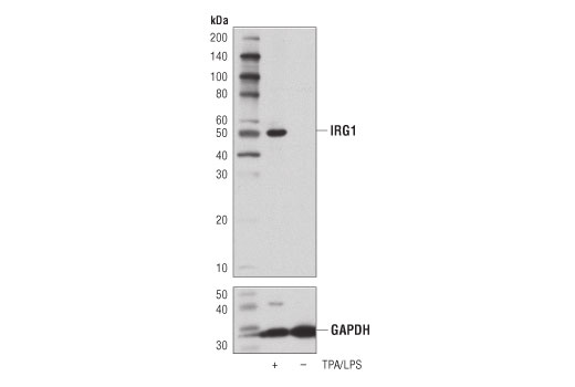 Western Blotting Image 1: IRG1 (D6H2Y) Rabbit mAb