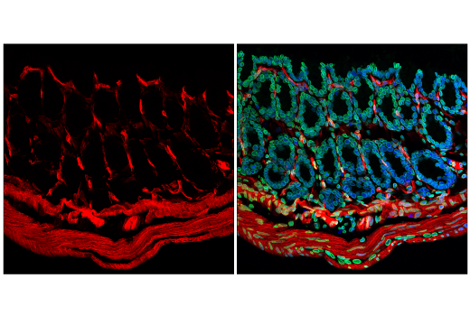 Immunofluorescence Image 1: Caveolin-1 (D46G3) XP<sup>®</sup> Rabbit mAb (Alexa Fluor<sup>®</sup> 647 Conjugate)