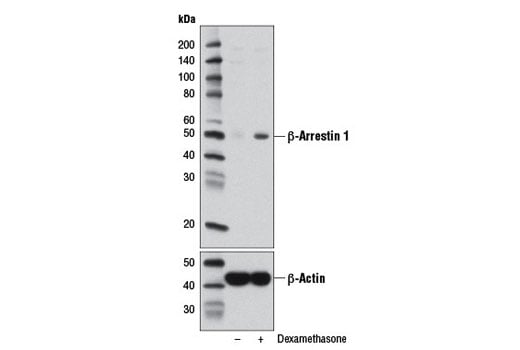 Western Blotting Image 2: beta-Arrestin 1 (D8O3J) Rabbit Monoclonal Antibody