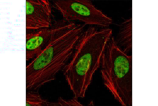 undefined Image 13: NuRD Complex Antibody Sampler Kit