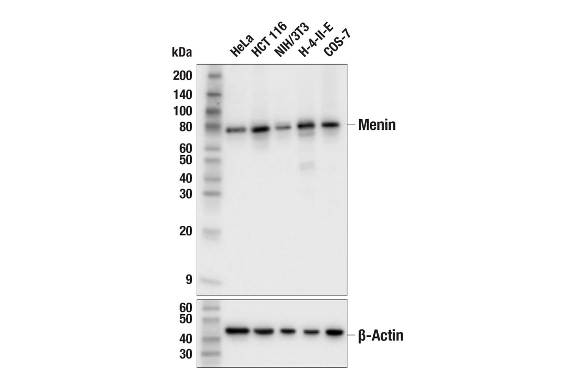 Western Blotting Image 2: Menin (E5P1R) Rabbit Monoclonal Antibody