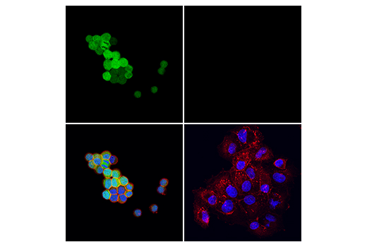 Immunofluorescence Image 1: Calretinin (E7R6O) XP<sup>®</sup> Rabbit mAb (BSA and Azide Free)