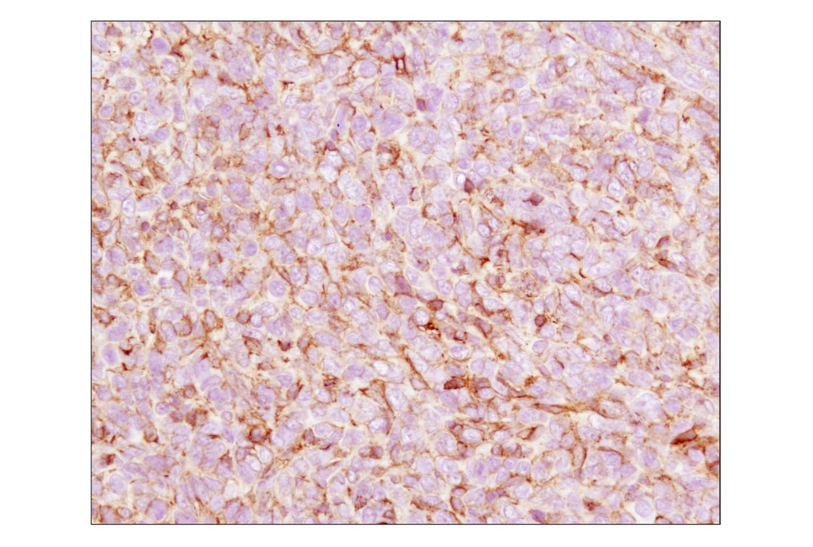 Immunohistochemistry Image 3: beta-Actin (13E5) Rabbit Monoclonal Antibody