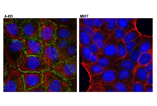 Immunofluorescence Image 1: P-Cadherin (12H6) Mouse Monoclonal Antibody