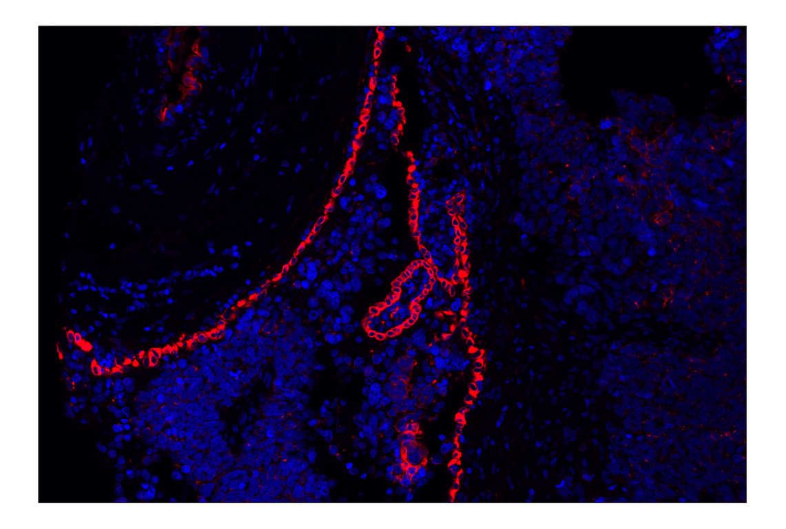 Immunohistochemistry Image 2: Keratin 8/18 (C51) Mouse Monoclonal Antibody (Alexa Fluor<sup>®</sup> 555 Conjugate)