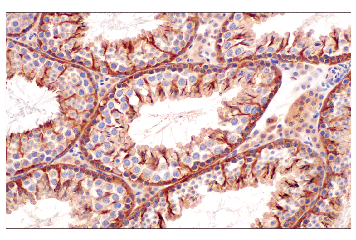Immunohistochemistry Image 9: MTAP (E5R1I) Rabbit Monoclonal Antibody