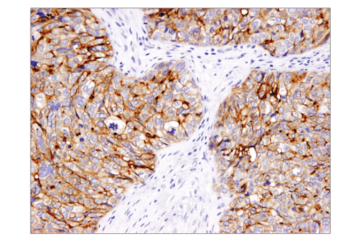 Immunohistochemistry Image 1: B7-H4 (D1M8I) Rabbit Monoclonal Antibody (BSA and Azide Free)
