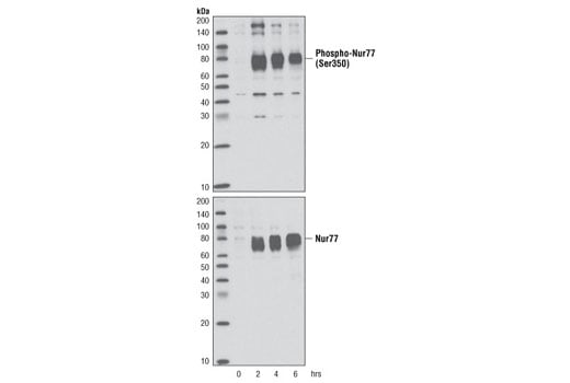 Western Blotting Image 2: Phospho-Nur77 (Ser351) (D22G5) Rabbit Monoclonal Antibody