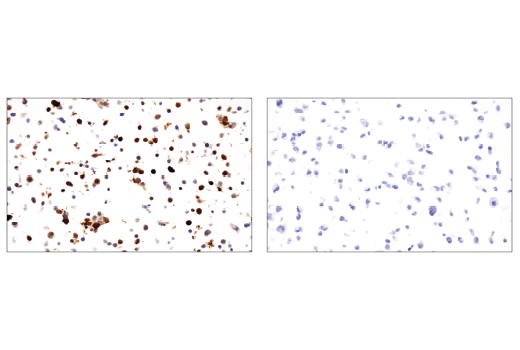 Immunohistochemistry Image 1: Cas9 (<i>S. pyogenes</i>) (E7M1H) Rabbit Monoclonal Antibody