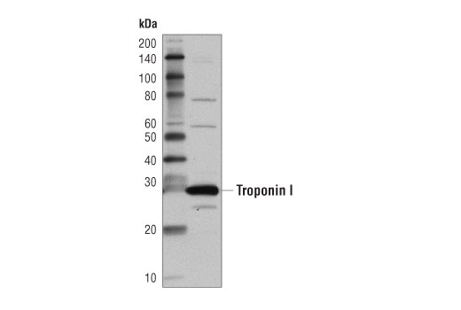 Western Blotting Image 2: Mouse Heart Tissue Control Extracts