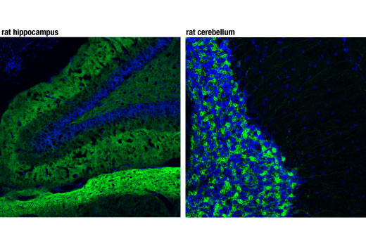Immunofluorescence Image 1: mGluR2 (D7D8M) Rabbit Monoclonal Antibody