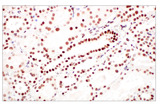 undefined Image 38: ATM Substrates Antibody Sampler Kit