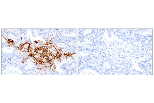 Immunohistochemistry Image 9: Glut1 (IHC404) Mouse Monoclonal Antibody