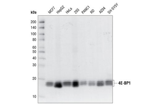 Western Blotting Image 2: 4E-BP1 (53H11) Rabbit Monoclonal Antibody (Biotinylated)