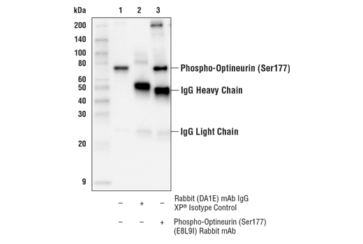 Immunoprecipitation Image 1: Phospho-Optineurin (Ser177) (E8L9I) Rabbit Monoclonal Antibody