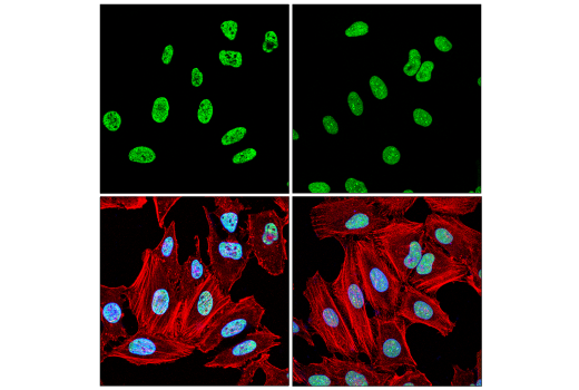 Immunofluorescence Image 2: NONO (E8Q3E) Rabbit Monoclonal Antibody