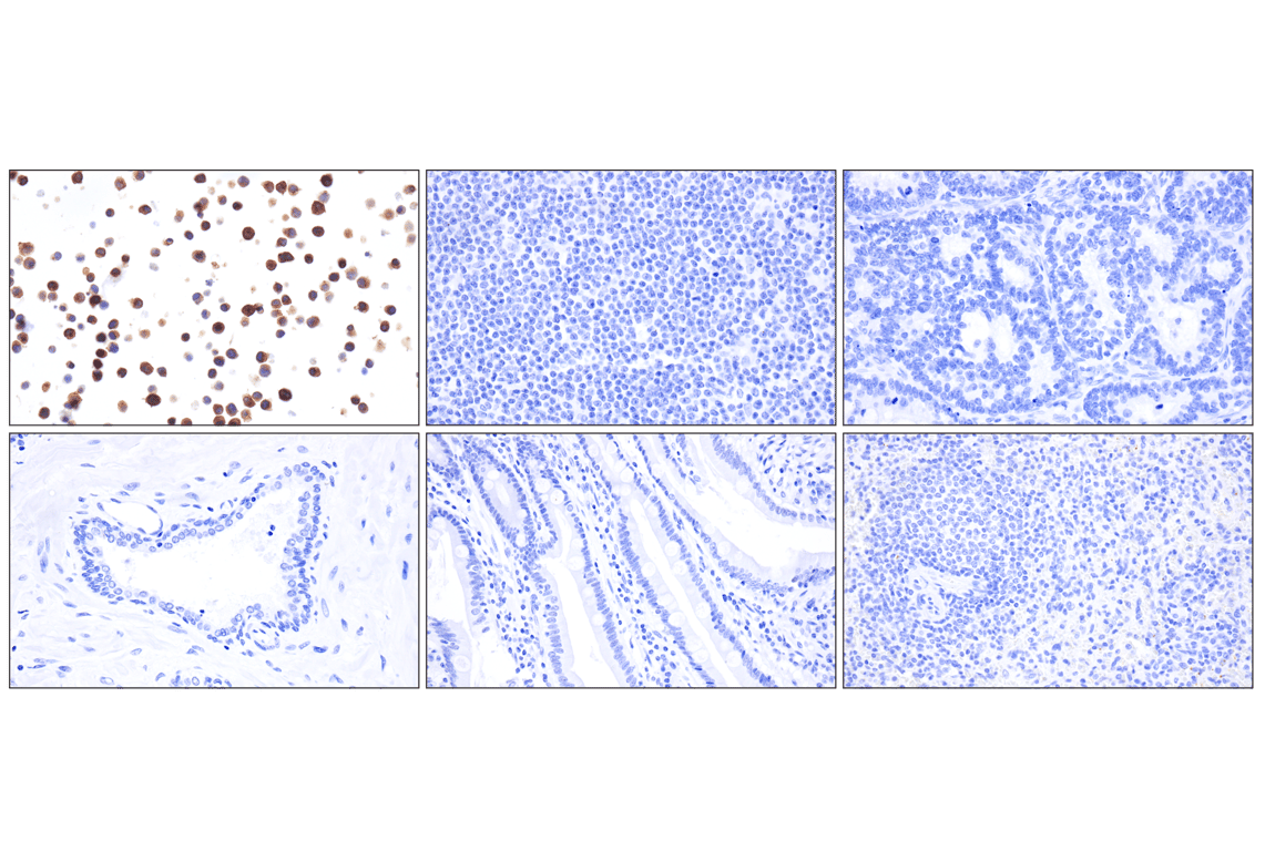 Immunohistochemistry Image 3: Whitlow/218 Linker (F2G3S) Rabbit Monoclonal Antibody
