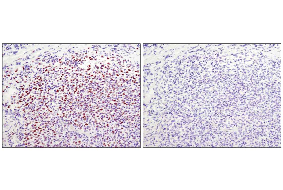H3k27me3 Antibody (Lys27) (C36B11) Rabbit MAb | Cell