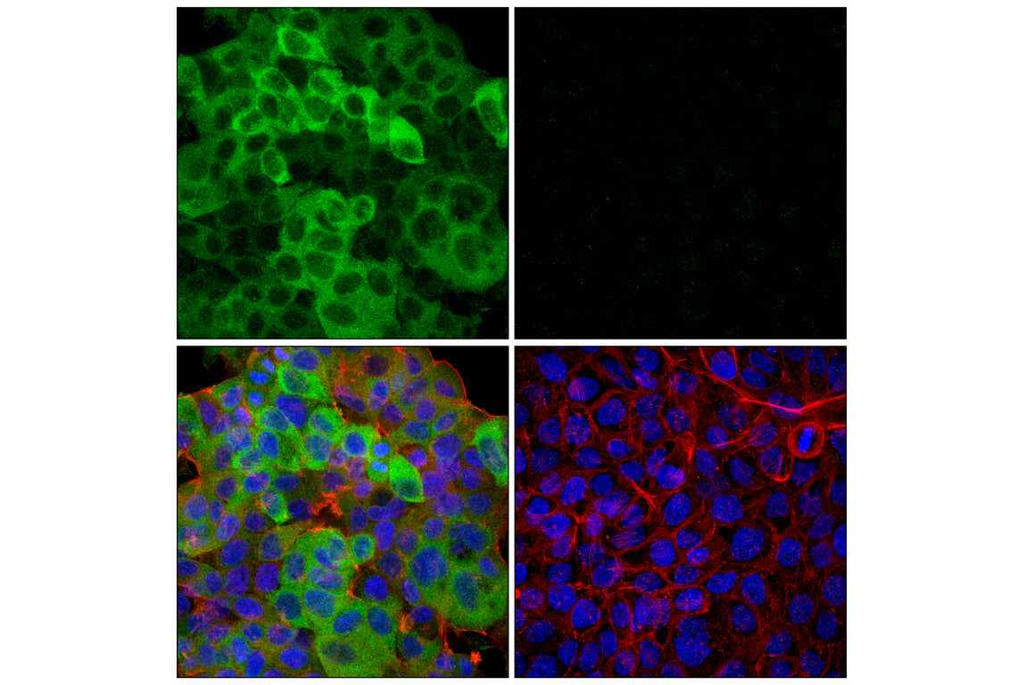 Immunofluorescence Image 2: NFAT1 (D43B1) Rabbit Monoclonal Antibody