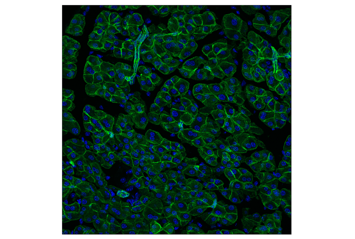 Immunofluorescence Image 2: E-Cadherin (24E10) Rabbit Monoclonal Antibody