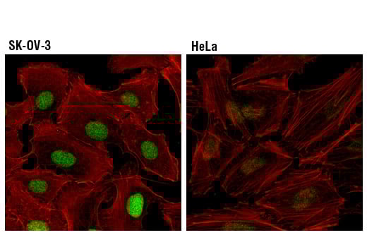Immunofluorescence Image 1: Sox17 (D1T8M) Rabbit Monoclonal Antibody