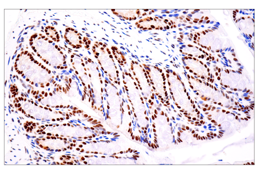 Immunohistochemistry Image 3: TDP43 (E2G6G) Rabbit Monoclonal Antibody