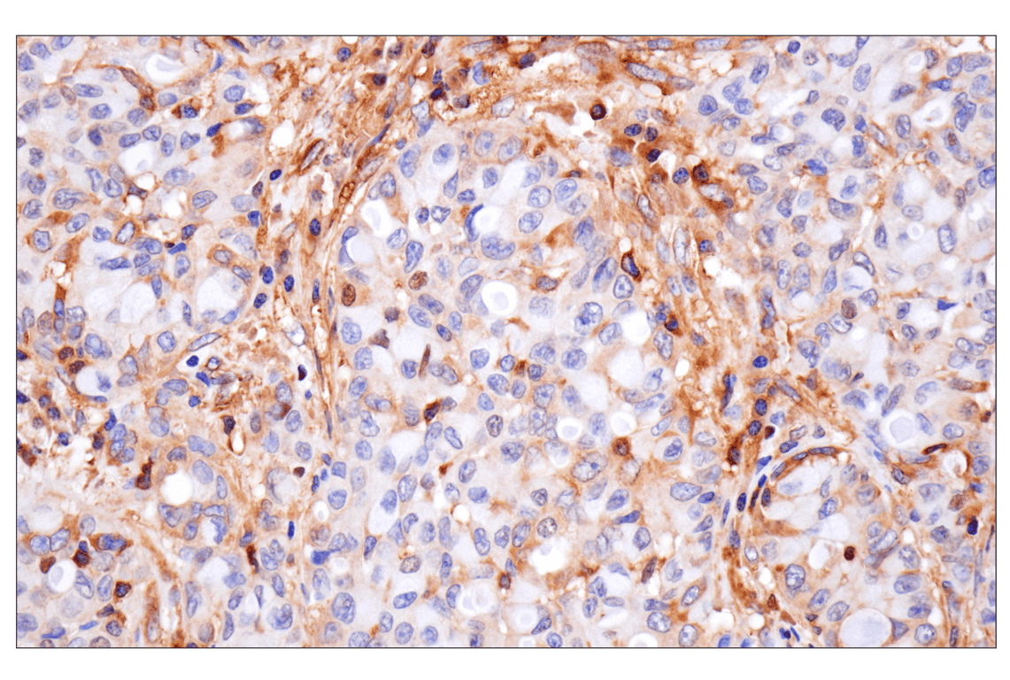 Immunohistochemistry Image 3: NF-kappaB p65 (D14E12) Rabbit Monoclonal Antibody