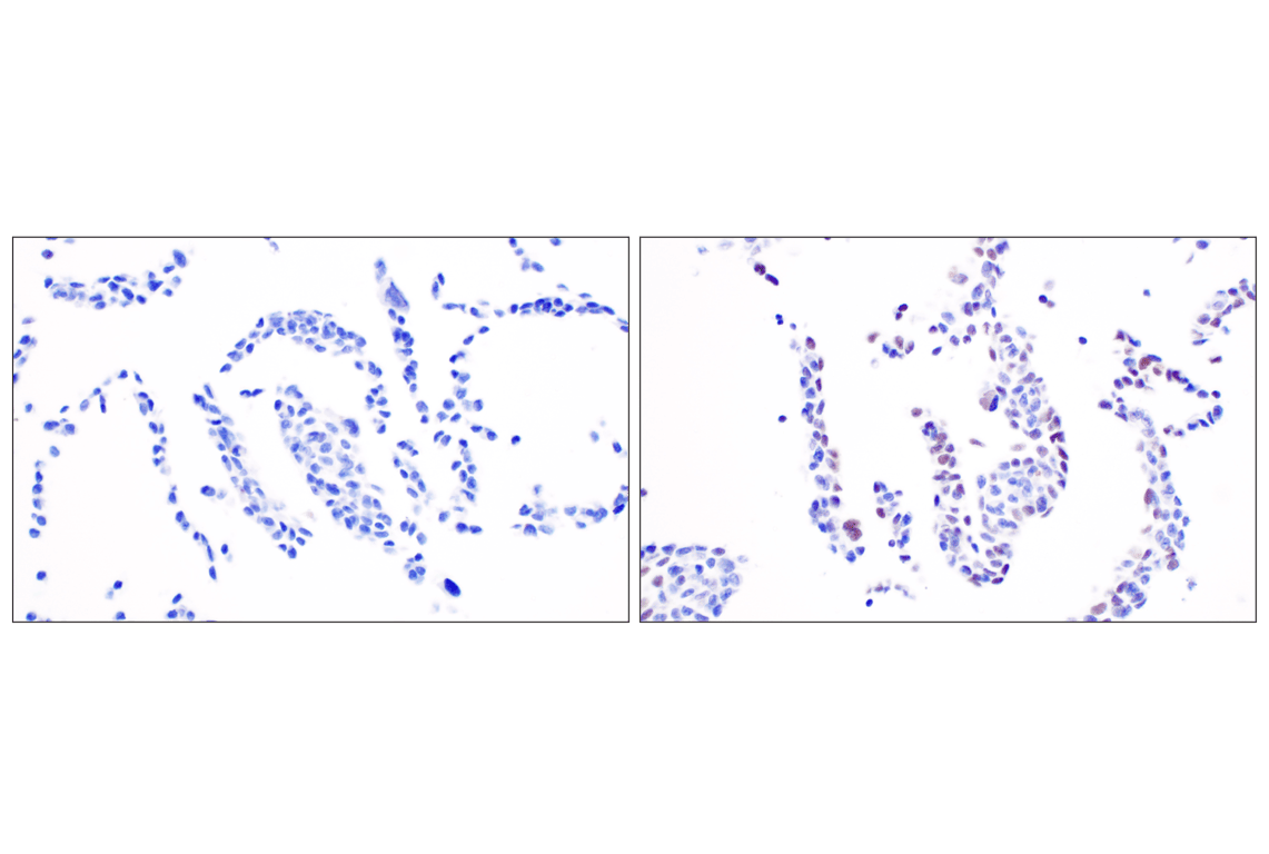 undefined Image 14: PhosphoPlus<sup>®</sup> DNA-PKcs (Ser2056) Antibody Duet