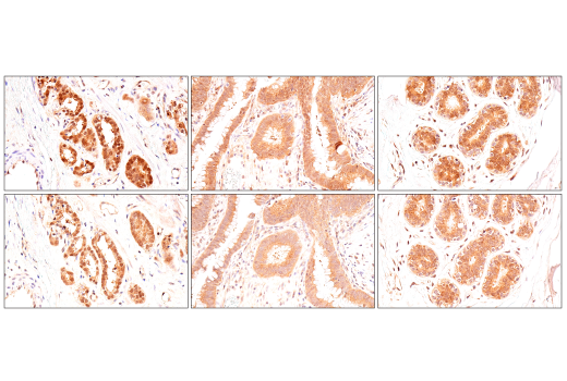 undefined Image 44: Phospho-Tau (Ser214/T217) Signaling Antibody Sampler Kit