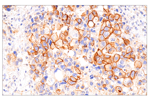 Immunohistochemistry Image 2: HER2/ErbB2 (CB11) Mouse Monoclonal Antibody