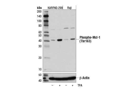 undefined Image 2: Pro-Survival Bcl-2 Family Antibody Sampler Kit II