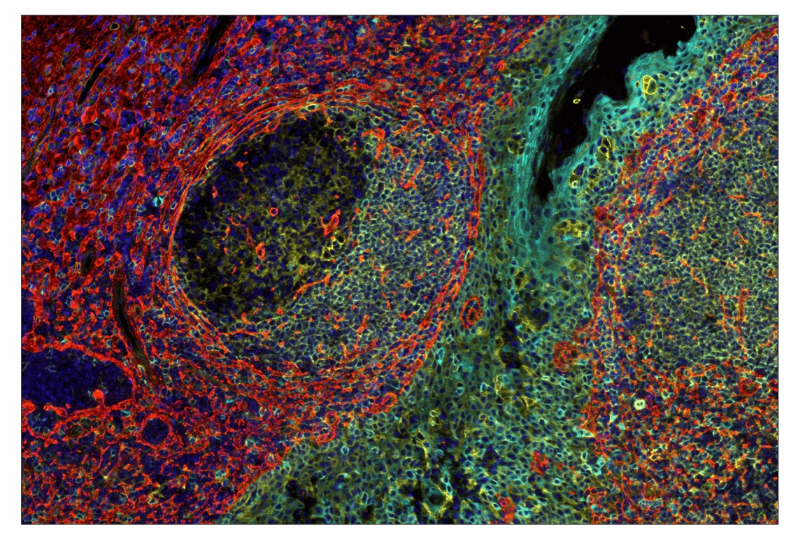 Immunohistochemistry Image 1: COL1A1 (E8F4L) & CO-0106-488 SignalStar<sup>™</sup> Oligo-Antibody Pair